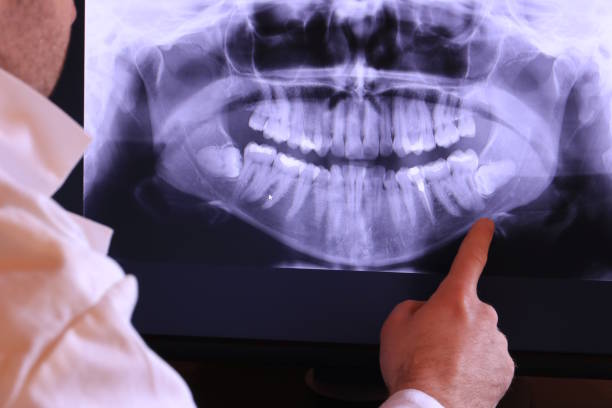 Best Tooth Infection Emergency Dentist  in Salamatof, AK